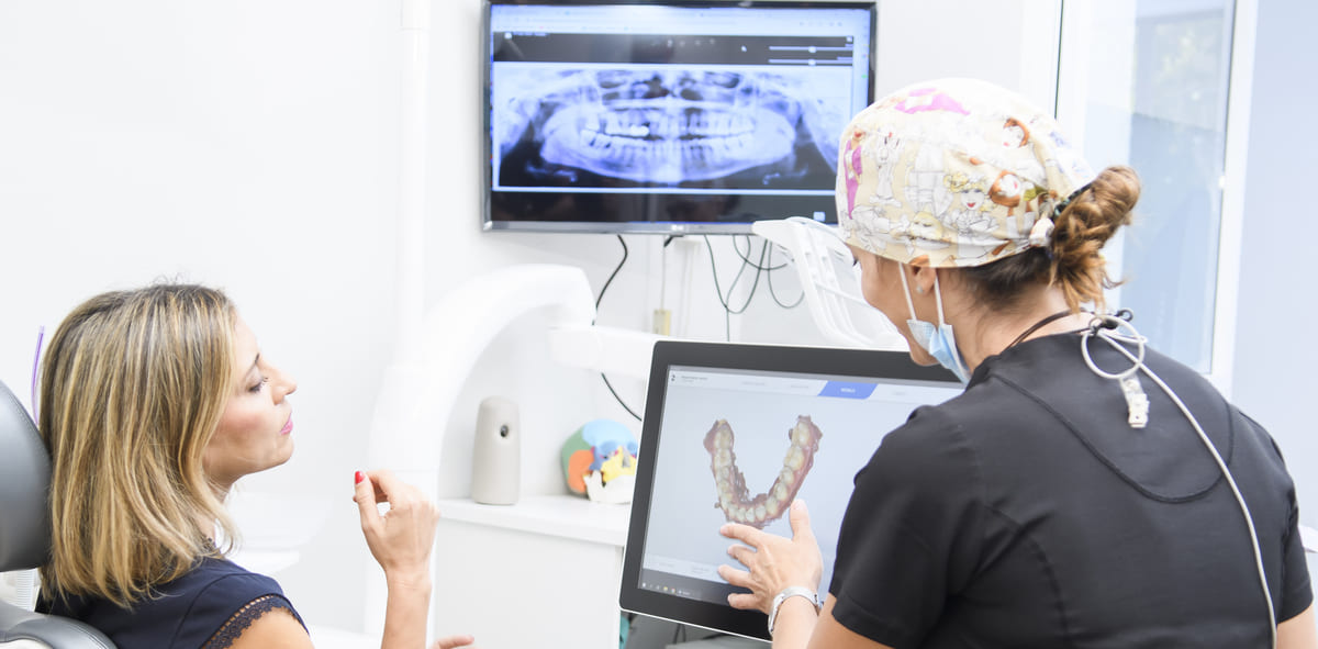 implantes dentales
