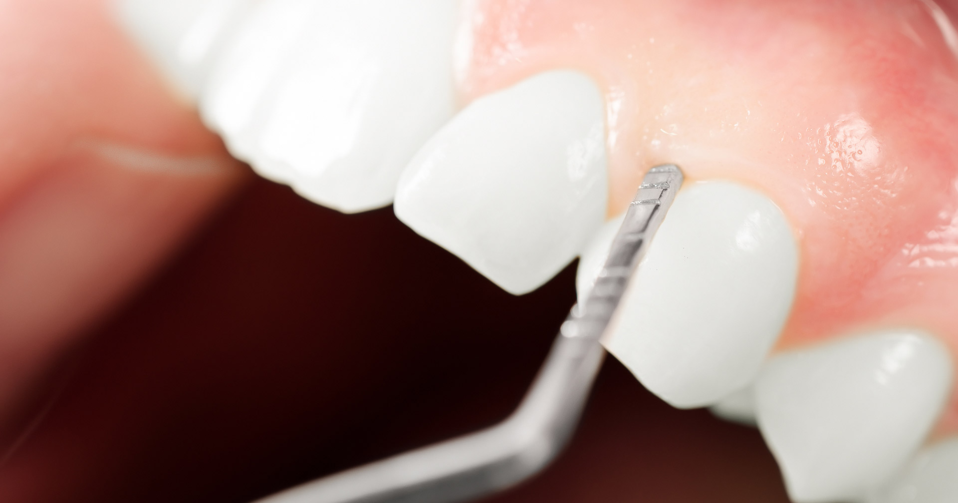 Periodoncia en sevilla
